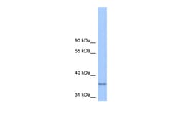 Aviva Systems Biology Corp PLPPR2 Antibody - middle region (ARP49743_P050)