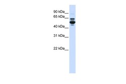 Aviva Systems Biology Corp CYP3A43 Antibody - C-terminal region (ARP49758_P050)
