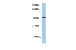 Aviva Systems Biology Corp TMEM149 Antibody - N-terminal region (ARP49852_P050)