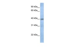 Aviva Systems Biology Corp TXNDC15 Antibody - C-terminal region (ARP49856_P050)