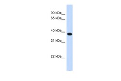 Aviva Systems Biology Corp ACBD4 Antibody - N-terminal region (ARP49857_P050)