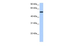 Aviva Systems Biology Corp UGT2A3 Antibody - middle region (ARP49862_P050)