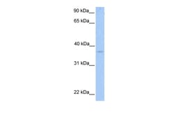 Aviva Systems Biology Corp NPAL2 Antibody - N-terminal region (ARP49863_P050)