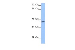 Aviva Systems Biology Corp UBA5 Antibody - middle region (ARP49880_P050)