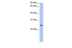 Aviva Systems Biology Corp NRSN2 Antibody - middle region (ARP49914_P050)
