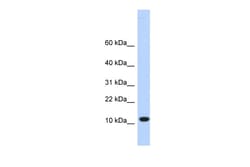 Aviva Systems Biology Corp C10orf57 Antibody - middle region (ARP49927_P050)