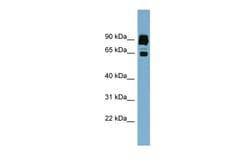 Aviva Systems Biology Corp CLPTM1L Antibody - middle region (ARP49959_P050)
