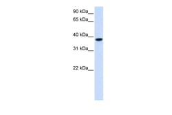 Aviva Systems Biology Corp GLT8D2 Antibody - C-terminal region (ARP49993_P050)