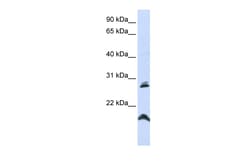 Aviva Systems Biology Corp SPATA9 Antibody - N-terminal region (ARP50024_P050)