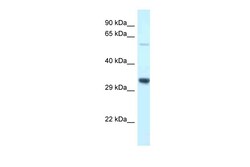 Aviva Systems Biology Corp Tmem117 Antibody - C-terminal region (ARP50052_P050)