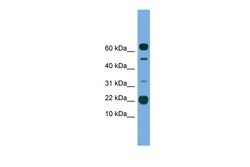 Aviva Systems Biology Corp TMEM107 Antibody - N-terminal region (ARP50065_P050)
