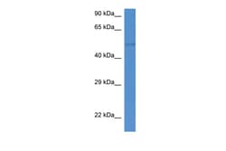 Aviva Systems Biology Corp St6gal2 Antibody - C-terminal region (ARP50078_P050)