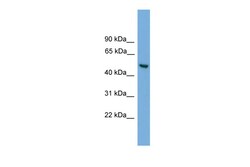 Aviva Systems Biology Corp ABHD1 Antibody - middle region (ARP50088_P050)