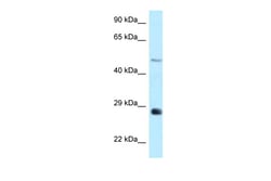 Aviva Systems Biology Corp GPAT3 Antibody - middle region (ARP50103_P050)