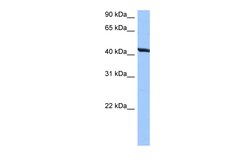 Aviva Systems Biology Corp TMEM118 Antibody - N-terminal region (ARP50130_P050)