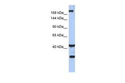 Aviva Systems Biology Corp DISP1 Antibody - middle region (ARP50142_P050)
