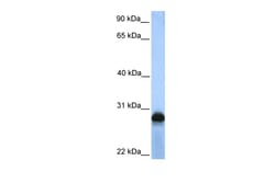 Aviva Systems Biology Corp SIGLEC12 Antibody - N-terminal region (ARP50183_P050)