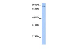 Aviva Systems Biology Corp SLITRK1 Antibody - N-terminal region (ARP50218_P050)