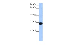 Aviva Systems Biology Corp SLAMF6 Antibody - N-terminal region (ARP50224_P050)