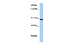 Aviva Systems Biology Corp AQP10 Antibody - C-terminal region (ARP50244_P050)