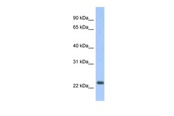 Aviva Systems Biology Corp ND6 Antibody (ARP50255_P050) | 100uL, Quantity: