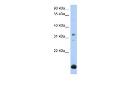 Aviva Systems Biology Corp B3GALT6 Antibody - N-terminal region (ARP50258_P050)