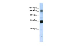 Aviva Systems Biology Corp COL11A2 Antibody - N-terminal region (ARP50265_P050)
