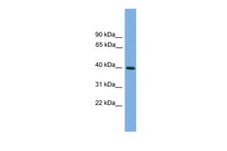 Aviva Systems Biology Corp ITLN2 Antibody - middle region (ARP50278_P050)