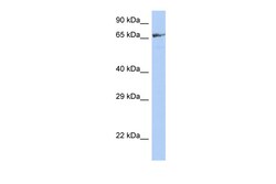 Aviva Systems Biology Corp ZNF676 Antibody - middle region (ARP50305_P050)