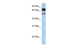 Aviva Systems Biology Corp ZNF780B Antibody - N-terminal region (ARP50337_P050)