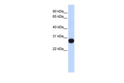 Aviva Systems Biology Corp TCEAL4 Antibody - middle region (ARP50341_P050)