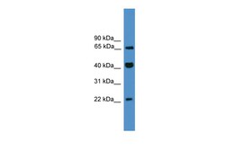 Aviva Systems Biology Corp TCEAL6 Antibody - C-terminal region (ARP50342_P050)
