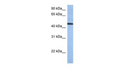 Aviva Systems Biology Corp ZNF766 Antibody - N-terminal region (ARP50358_P050)