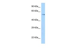 Aviva Systems Biology Corp Zik1 Antibody - C-terminal region (ARP50363_P050)