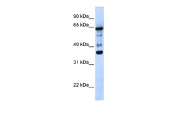 Aviva Systems Biology Corp ZNF630 Antibody - N-terminal region (ARP50428_P050)