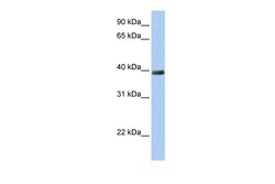 Aviva Systems Biology Corp ZNF391 Antibody - N-terminal region (ARP50450_P050)