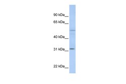 Aviva Systems Biology Corp ZFYVE19 Antibody - C-terminal region (ARP50452_P050)