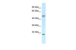Aviva Systems Biology Corp Zfp113 Antibody - middle region (ARP50471_P050)