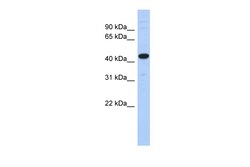 Aviva Systems Biology Corp UBA3 Antibody - N-terminal region (ARP50493_P050)