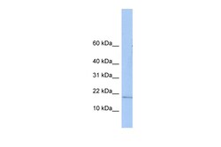 Aviva Systems Biology Corp ZNHIT3 Antibody - N-terminal region (ARP50503_P050)