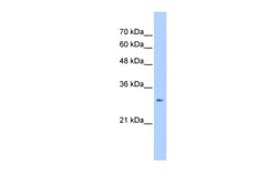 Aviva Systems Biology Corp ING1 Antibody - C-terminal region (ARP50512_T100)