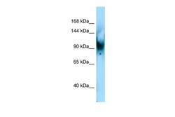 Aviva Systems Biology Corp Senp6 Antibody - C-terminal region (ARP50599_P050)
