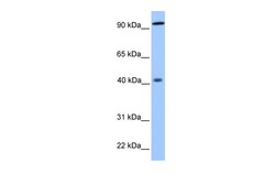Aviva Systems Biology Corp PYGO1 Antibody - N-terminal region (ARP50601_P050)