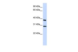 Aviva Systems Biology Corp ING4 Antibody - middle region (ARP50608_P050)