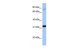 Aviva Systems Biology Corp TIPIN Antibody - middle region (ARP50621_P050)