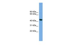 Aviva Systems Biology Corp BRF2 Antibody - middle region (ARP50631_P050)