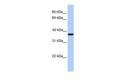 Aviva Systems Biology Corp ZC3H15 Antibody - middle region (ARP50635_P050)