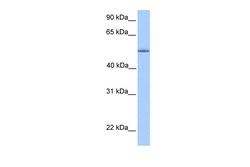 Aviva Systems Biology Corp ZNF708 Antibody - C-terminal region (ARP50663_P050)