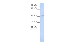 Aviva Systems Biology Corp SMYD3 Antibody - N-terminal region (ARP50666_P050)