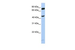 Aviva Systems Biology Corp SMYD3 Antibody - C-terminal region (ARP50667_P050)